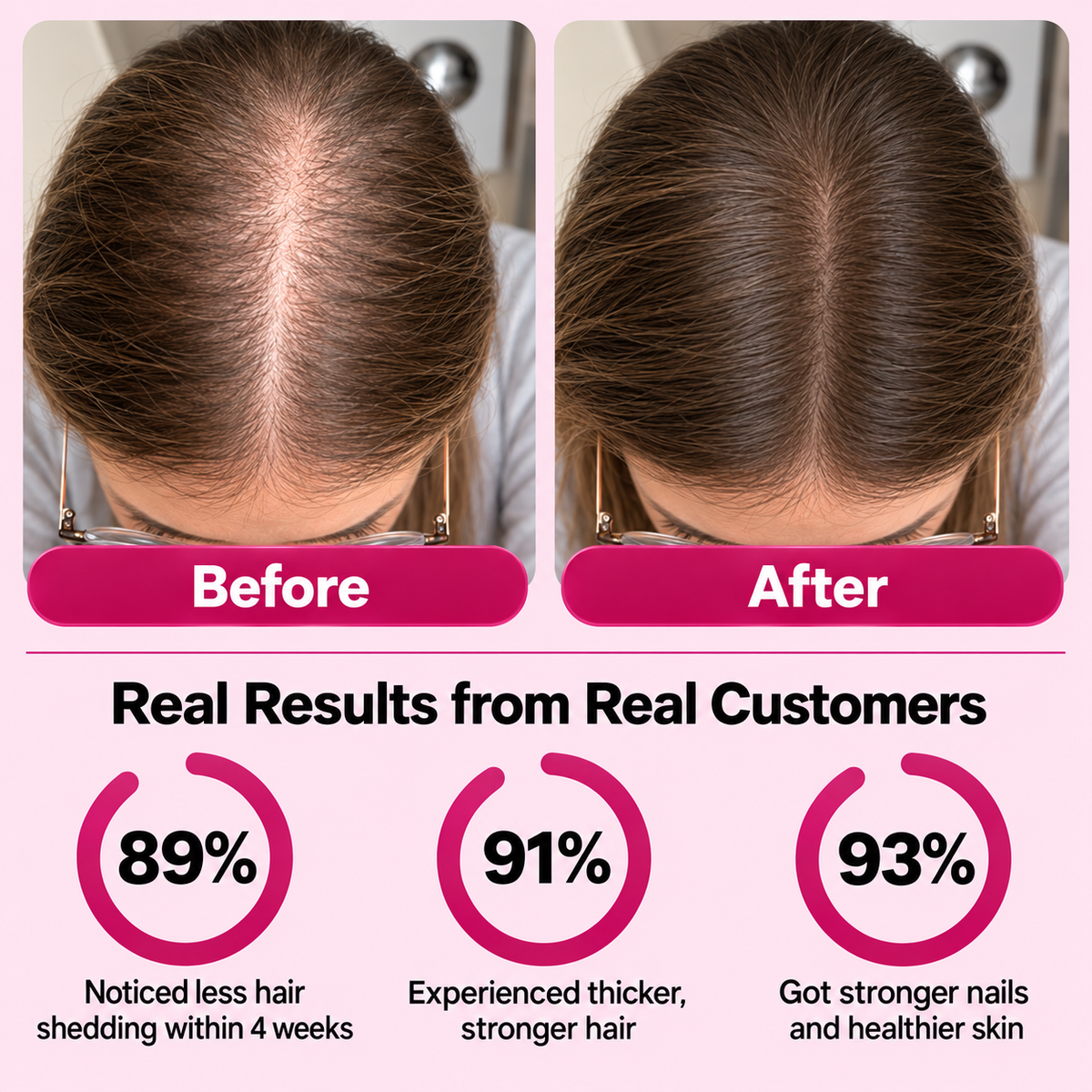 Biotin Gummies – For Longer, Thicker & Stronger Hair